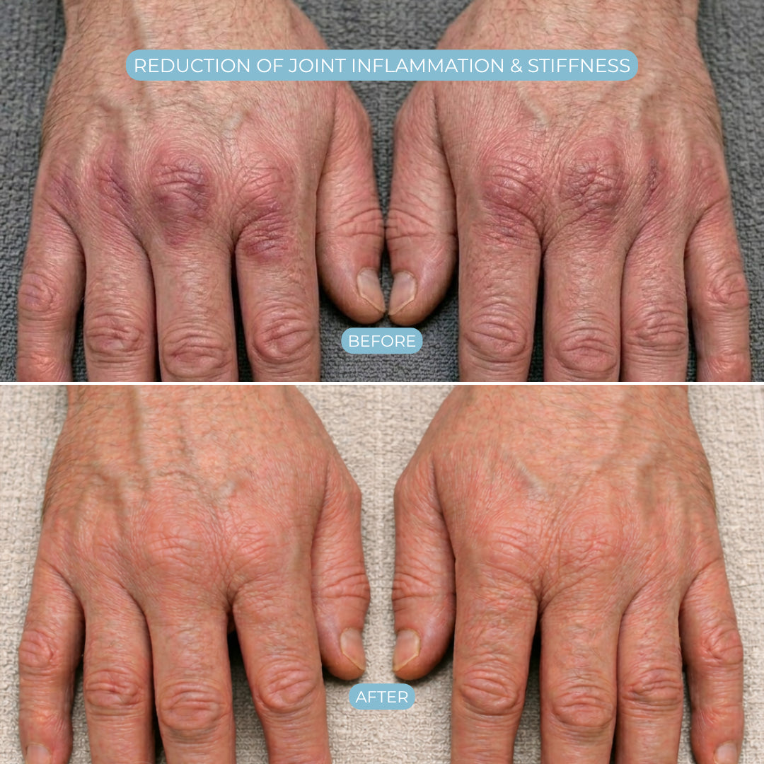 Advanced Therapeutic Glove for Instant Hand Relief