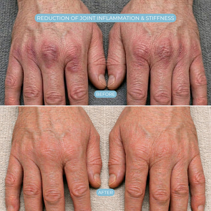 Advanced Therapeutic Glove for Instant Hand Relief